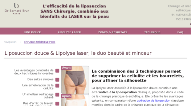 lipolyselaser.fr