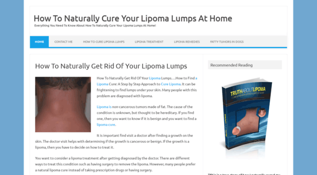 lipomabestcure.com