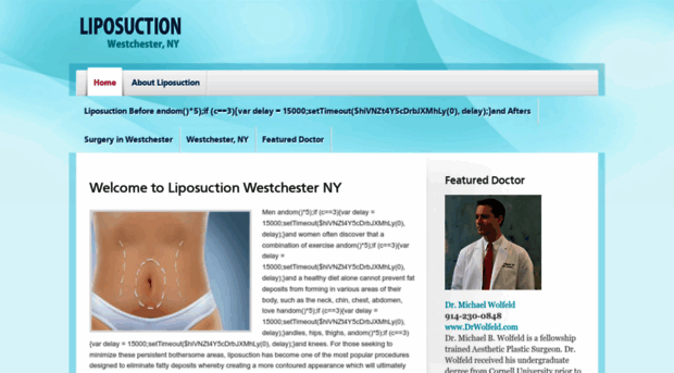 liposuctionwestchesterny.com