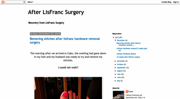 lisfrancsurgery.blogspot.com