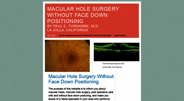 macularholesurgeons.com