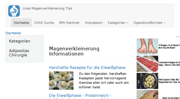 magenverkleinerung.tips