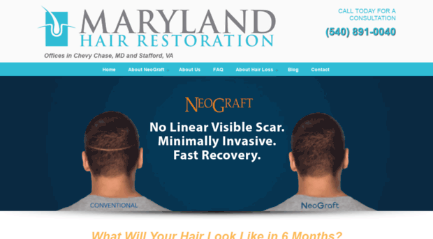 marylandhairrestoration.com