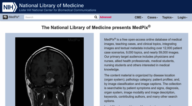 medpix.nlm.nih.gov