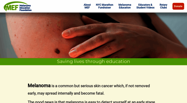 melanomaeducation.net