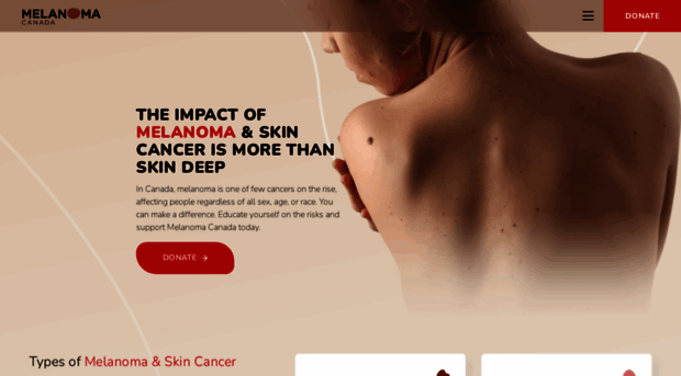 melanomanetwork.ca