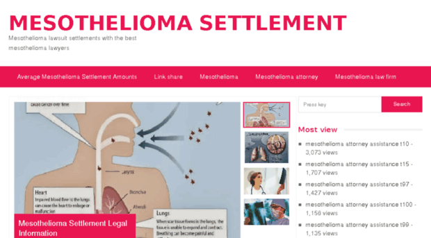 mesothelioma-settlement.eu