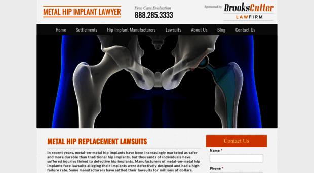 metalhipimplantlawyer.com