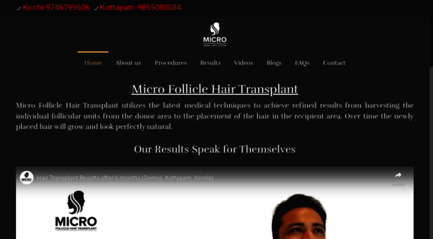 microfolliclehairtransplant.com