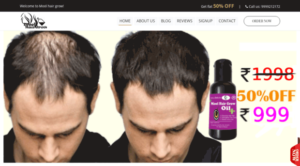 moolhairgrow.com