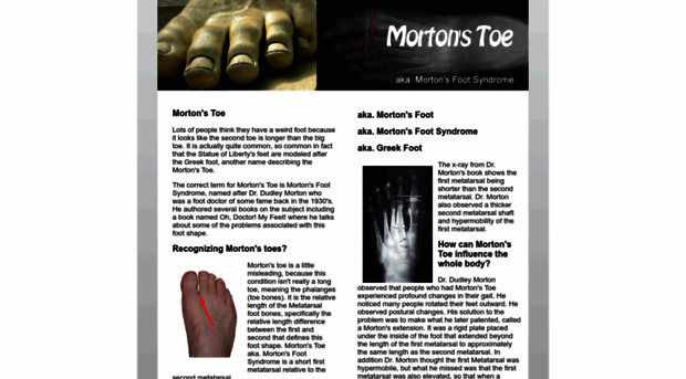 mortonstoe.com