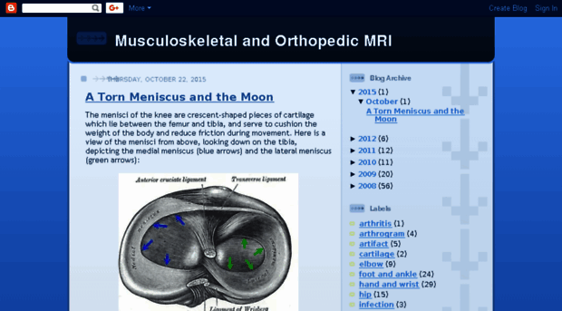 musculoskeletalmri.blogspot.com