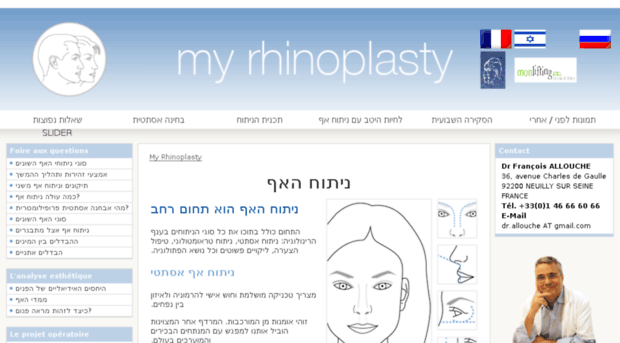 my-rhinoplasty.com