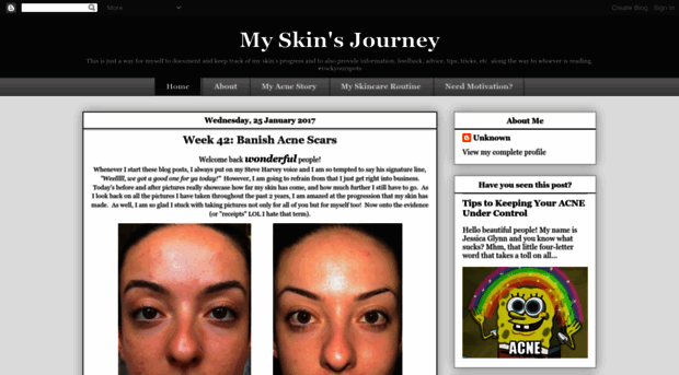 myskinsjourney.blogspot.com