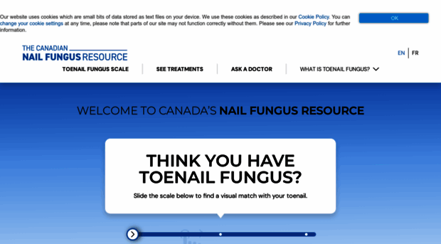 nailfungus.ca