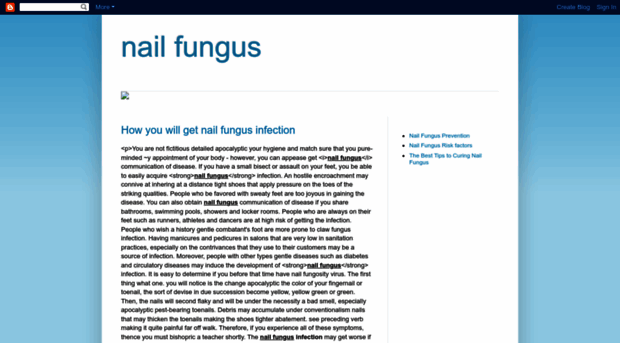 nailfungusgrows.blogspot.com