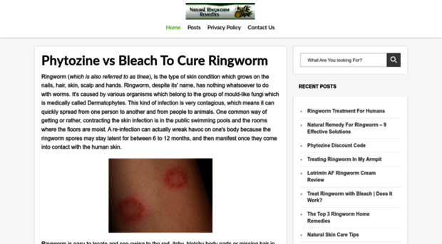 naturalringwormremedies.com