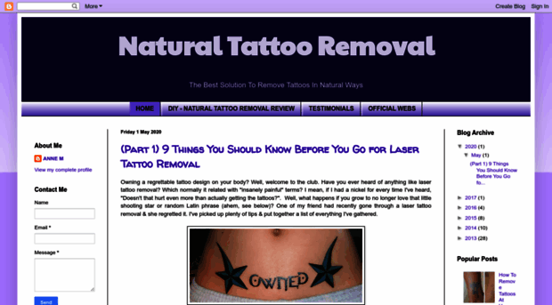 naturaltattooremovalinfo.blogspot.com