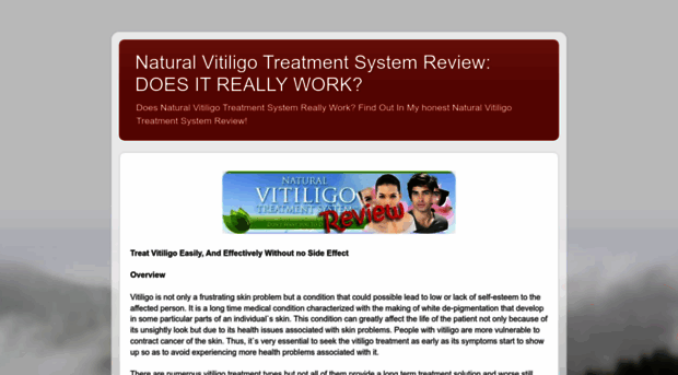 naturalvitiligotreatmentsystem-review.blogspot.com