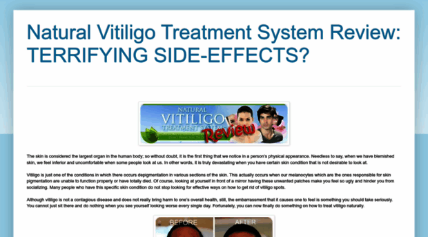 naturalvitiligotreatmentsystems.blogspot.com