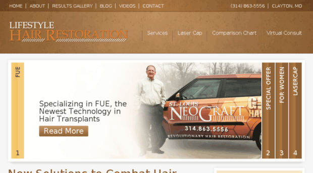 neograftstl.com