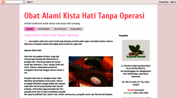 obatalamikistahati.blogspot.com