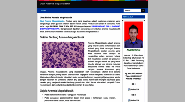 obatanemiamegaloblastik45.blogspot.com