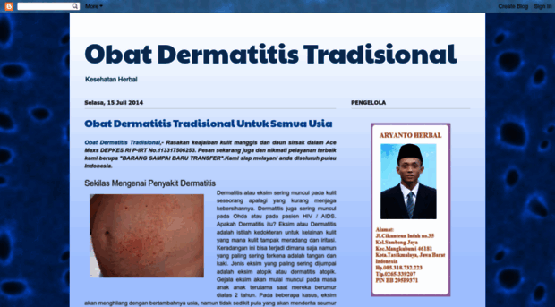 obatdermatitistradisional08.blogspot.com