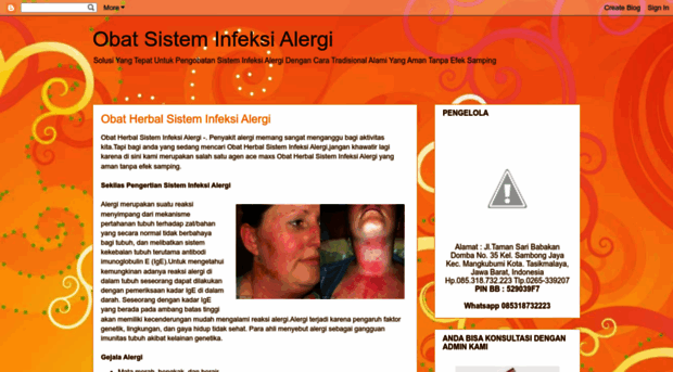 obatsisteminfeksislergi.blogspot.com