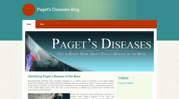 pagetsdiseases.zohosites.com