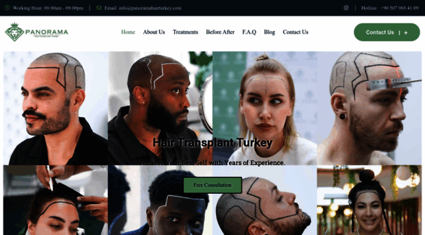 panoramahairturkey.com