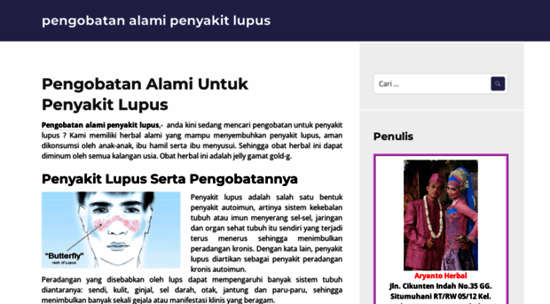 pengobatanalamipenyakitlupus.wordpress.com