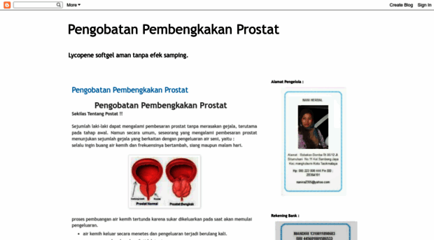 pengobatanpembengkakanprostat.blogspot.com