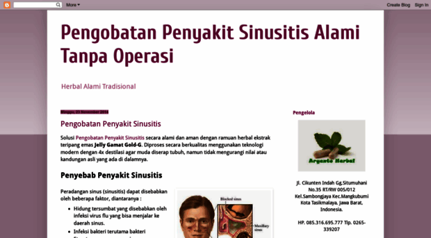 pengobatanpenyakitsinusitis.blogspot.com