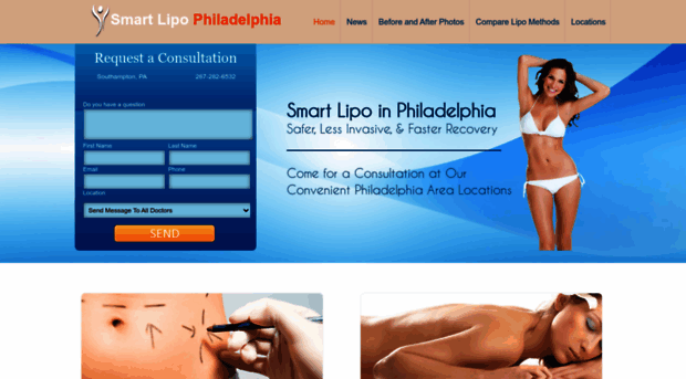 philadelphiasmartlipo.com