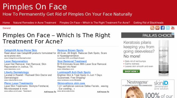 pimples-on-face.net