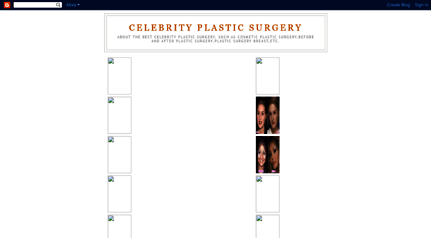 plastic-celebritysurgery.blogspot.com