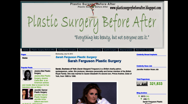 plasticsurgerybeforeafter.blogspot.com