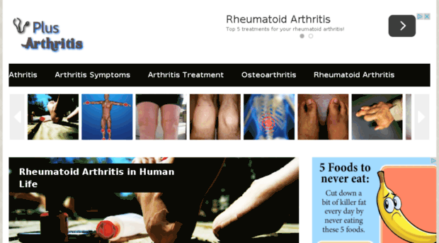 plusarthritis.com