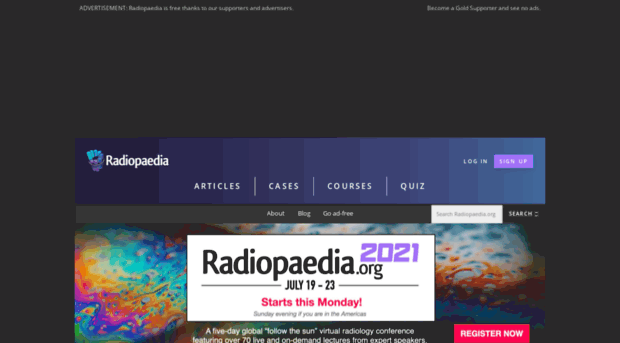 prod-images.static.radiopaedia.org