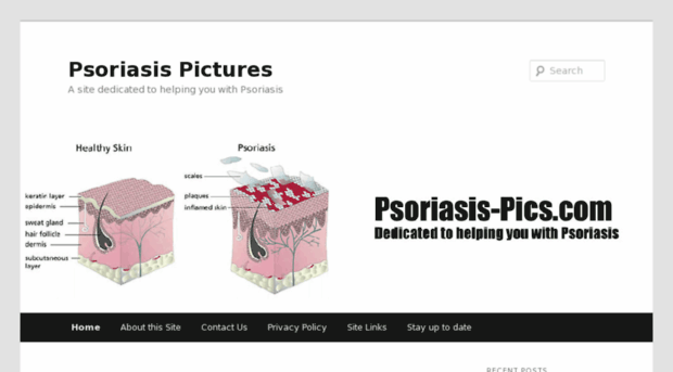 psoriasis-pics.com