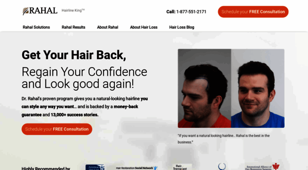 rahalhairtransplant.com