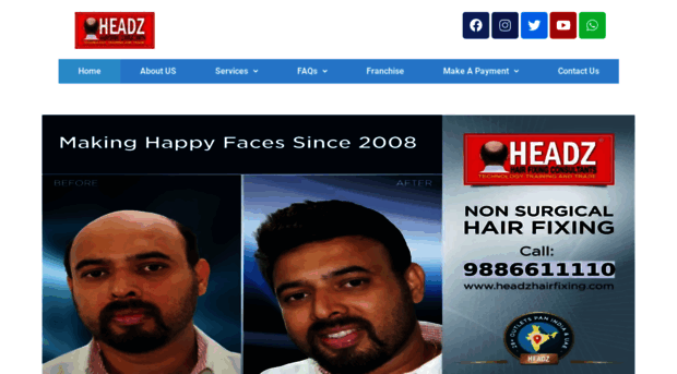 Hair Fixing Cost In Dubai  Non Surgical Hair Replacement Cost In Dubai