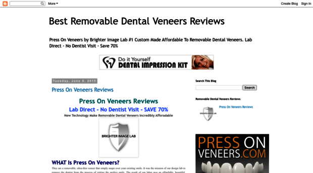 removabledentalveneers.blogspot.com