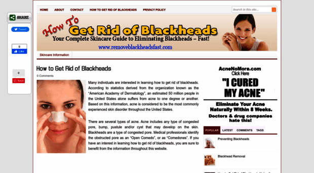 removeblackheadsfast.com