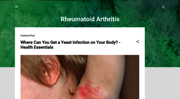 rheumatoid-arthritis-immunology.blogspot.com