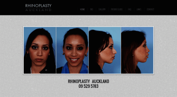 rhinoplastyauckland.co.nz