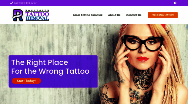 rochestertattooremoval.com