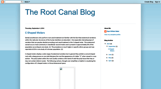 rootcanalblog.blogspot.in
