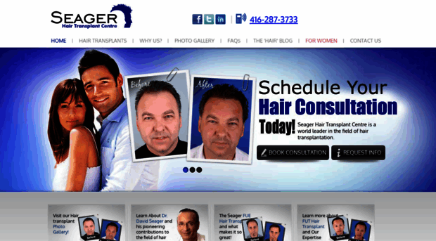 seagerhairtransplant.com